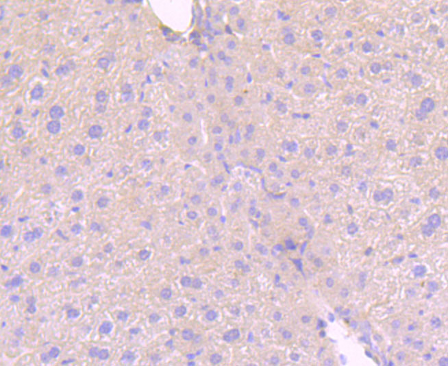 Immunohistochemical analysis of paraffin-embedded mouse colon tissue using anti-MLKL (phospho S345) antibody. The section was pre-treated using heat mediated antigen retrieval with Tris-EDTA buffer (pH 9.0) for 20 minutes.The tissues were blocked in 5% BSA for 30 minutes at room temperature, washed with ddH2O and PBS, and then probed with the primary antibody (ET1705-51, 1/50) for 30 minutes at room temperature. The detection was performed using an HRP conjugated compact polymer system. DAB was used as the chromogen. Tissues were counterstained with hematoxylin and mounted with DPX.