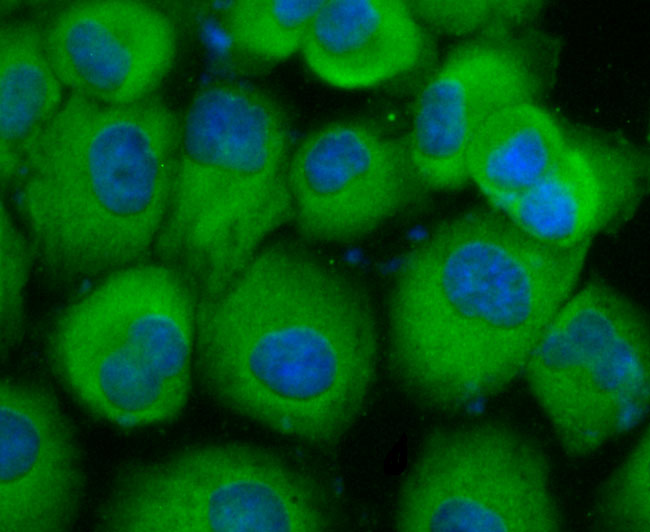 ICC staining of Carcino Embryonic Antigen CEA in MCF-7 cells (green). Formalin fixed cells were permeabilized with 0.1% Triton X-100 in TBS for 10 minutes at room temperature and blocked with 10% negative goat serum for 15 minutes at room temperature. Cells were probed with the primary antibody (ET1705-52, 1/50) for 1 hour at room temperature, washed with PBS. Alexa Fluor®488 conjugate-Goat anti-Rabbit IgG was used as the secondary antibody at 1/1,000 dilution. The nuclear counter stain is DAPI (blue).