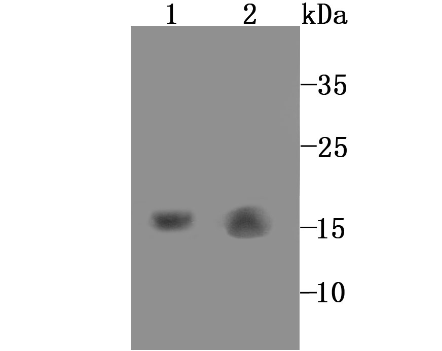 Western blot analysis of GABARAP on different lysates. Proteins were transferred to a PVDF membrane and blocked with 5% BSA in PBS for 1 hour at room temperature. The primary antibody (ET1705-53, 1/500) was used in 5% BSA at room temperature for 2 hours. Goat Anti-Rabbit IgG - HRP Secondary Antibody (HA1001) at 1:200,000 dilution was used for 1 hour at room temperature.<br />
Positive control: <br />
Lane 1: Mouse kidney tissue lysate<br />
Lane 2: Rat liver tissue lysate