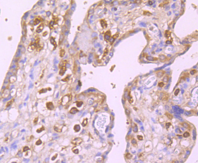 Immunohistochemical analysis of paraffin-embedded human placenta tissue using anti-GABARAP antibody. The section was pre-treated using heat mediated antigen retrieval with Tris-EDTA buffer (pH 8.0-8.4) for 20 minutes.The tissues were blocked in 5% BSA for 30 minutes at room temperature, washed with ddH2O and PBS, and then probed with the primary antibody (ET1705-53, 1/50) for 30 minutes at room temperature. The detection was performed using an HRP conjugated compact polymer system. DAB was used as the chromogen. Tissues were counterstained with hematoxylin and mounted with DPX.