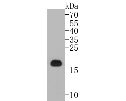 Western blot analysis of Ferritin Light Chain on rat liver tissue lysates. Proteins were transferred to a PVDF membrane and blocked with 5% BSA in PBS for 1 hour at room temperature. The primary antibody (ET1705-54, 1/500) was used in 5% BSA at room temperature for 2 hours. Goat Anti-Rabbit IgG - HRP Secondary Antibody (HA1001) at 1:5,000 dilution was used for 1 hour at room temperature.
