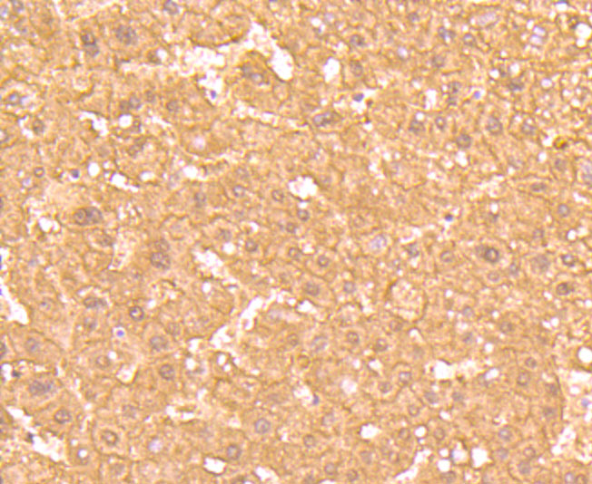 Immunohistochemical analysis of paraffin-embedded human liver tissue using anti-Ferritin Light Chain antibody. The section was pre-treated using heat mediated antigen retrieval with Tris-EDTA buffer (pH 8.0-8.4) for 20 minutes.The tissues were blocked in 5% BSA for 30 minutes at room temperature, washed with ddH2O and PBS, and then probed with the primary antibody (ET1705-54, 1/50) for 30 minutes at room temperature. The detection was performed using an HRP conjugated compact polymer system. DAB was used as the chromogen. Tissues were counterstained with hematoxylin and mounted with DPX.