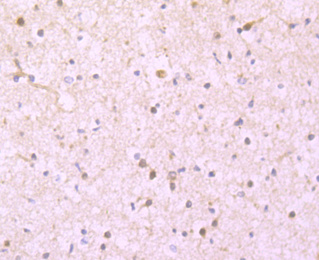 Immunohistochemical analysis of paraffin-embedded human brain tissue using anti-Ferritin Light Chain antibody. The section was pre-treated using heat mediated antigen retrieval with Tris-EDTA buffer (pH 8.0-8.4) for 20 minutes.The tissues were blocked in 5% BSA for 30 minutes at room temperature, washed with ddH2O and PBS, and then probed with the primary antibody (ET1705-54, 1/50) for 30 minutes at room temperature. The detection was performed using an HRP conjugated compact polymer system. DAB was used as the chromogen. Tissues were counterstained with hematoxylin and mounted with DPX.