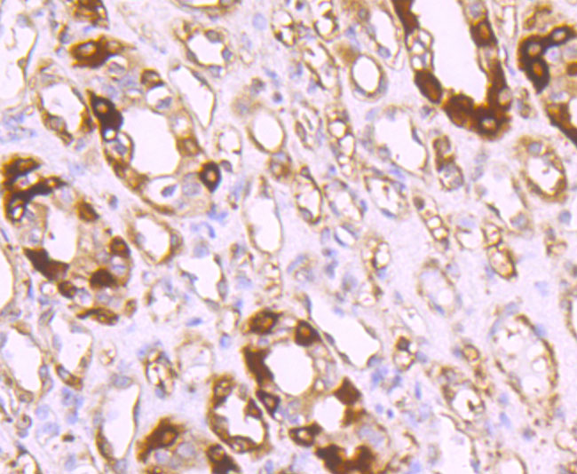 Immunohistochemical analysis of paraffin-embedded human kidney tissue using anti-Ferritin Light Chain antibody. The section was pre-treated using heat mediated antigen retrieval with Tris-EDTA buffer (pH 8.0-8.4) for 20 minutes.The tissues were blocked in 5% BSA for 30 minutes at room temperature, washed with ddH2O and PBS, and then probed with the primary antibody (ET1705-54, 1/50) for 30 minutes at room temperature. The detection was performed using an HRP conjugated compact polymer system. DAB was used as the chromogen. Tissues were counterstained with hematoxylin and mounted with DPX.