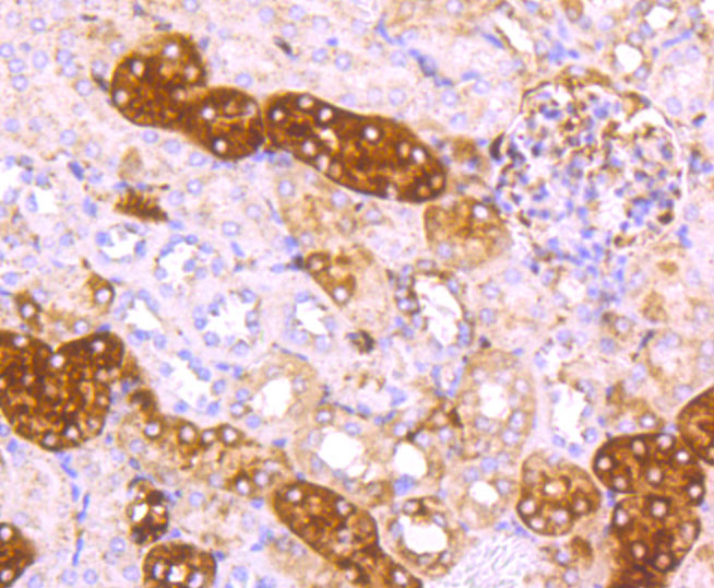 Immunohistochemical analysis of paraffin-embedded mouse kidney tissue using anti-Ferritin Light Chain antibody. The section was pre-treated using heat mediated antigen retrieval with Tris-EDTA buffer (pH 8.0-8.4) for 20 minutes.The tissues were blocked in 5% BSA for 30 minutes at room temperature, washed with ddH2O and PBS, and then probed with the primary antibody (ET1705-54, 1/50) for 30 minutes at room temperature. The detection was performed using an HRP conjugated compact polymer system. DAB was used as the chromogen. Tissues were counterstained with hematoxylin and mounted with DPX.