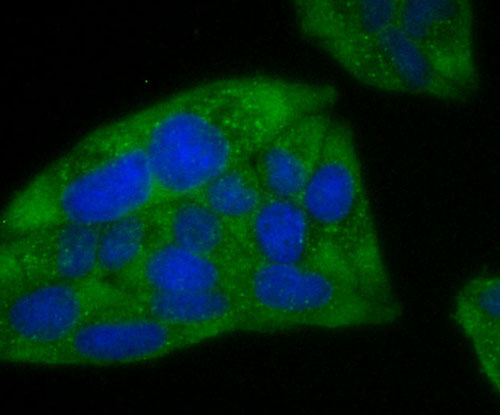 ICC staining of Ferritin Heavy Chain in A549 cells (green). Formalin fixed cells were permeabilized with 0.1% Triton X-100 in TBS for 10 minutes at room temperature and blocked with 1% Blocker BSA for 15 minutes at room temperature. Cells were probed with the primary antibody (ET1705-55, 1/50) for 1 hour at room temperature, washed with PBS. Alexa Fluor®488 Goat anti-Rabbit IgG was used as the secondary antibody at 1/1,000 dilution. The nuclear counter stain is DAPI (blue).