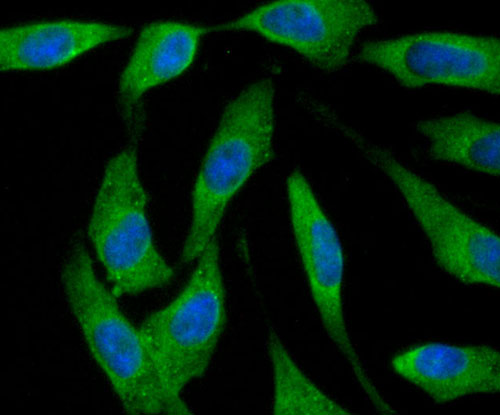 ICC staining of Ferritin Heavy Chain in Hela cells (green). Formalin fixed cells were permeabilized with 0.1% Triton X-100 in TBS for 10 minutes at room temperature and blocked with 1% Blocker BSA for 15 minutes at room temperature. Cells were probed with the primary antibody (ET1705-55, 1/50) for 1 hour at room temperature, washed with PBS. Alexa Fluor®488 Goat anti-Rabbit IgG was used as the secondary antibody at 1/1,000 dilution. The nuclear counter stain is DAPI (blue).