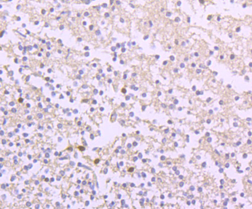 ICC staining of Ferritin Heavy Chain in PC-3M cells (green). Formalin fixed cells were permeabilized with 0.1% Triton X-100 in TBS for 10 minutes at room temperature and blocked with 1% Blocker BSA for 15 minutes at room temperature. Cells were probed with the primary antibody (ET1705-55, 1/50) for 1 hour at room temperature, washed with PBS. Alexa Fluor®488 Goat anti-Rabbit IgG was used as the secondary antibody at 1/1,000 dilution. The nuclear counter stain is DAPI (blue).