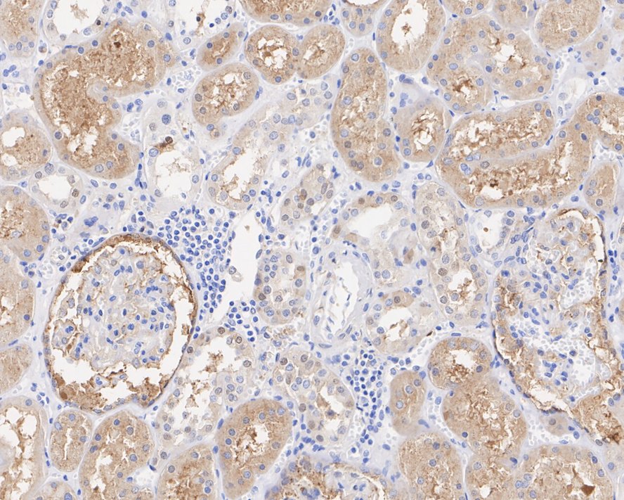 Immunohistochemical analysis of paraffin-embedded human brain tissue using anti-Ferritin Heavy Chain antibody. The section was pre-treated using heat mediated antigen retrieval with Tris-EDTA buffer (pH 8.0-8.4) for 20 minutes.The tissues were blocked in 5% BSA for 30 minutes at room temperature, washed with ddH2O and PBS, and then probed with the primary antibody (ET1705-55, 1/50) for 30 minutes at room temperature. The detection was performed using an HRP conjugated compact polymer system. DAB was used as the chromogen. Tissues were counterstained with hematoxylin and mounted with DPX.