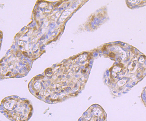 Immunohistochemical analysis of paraffin-embedded human kidney tissue using anti-Ferritin Heavy Chain antibody. The section was pre-treated using heat mediated antigen retrieval with Tris-EDTA buffer (pH 8.0-8.4) for 20 minutes.The tissues were blocked in 5% BSA for 30 minutes at room temperature, washed with ddH2O and PBS, and then probed with the primary antibody (ET1705-55, 1/50) for 30 minutes at room temperature. The detection was performed using an HRP conjugated compact polymer system. DAB was used as the chromogen. Tissues were counterstained with hematoxylin and mounted with DPX.