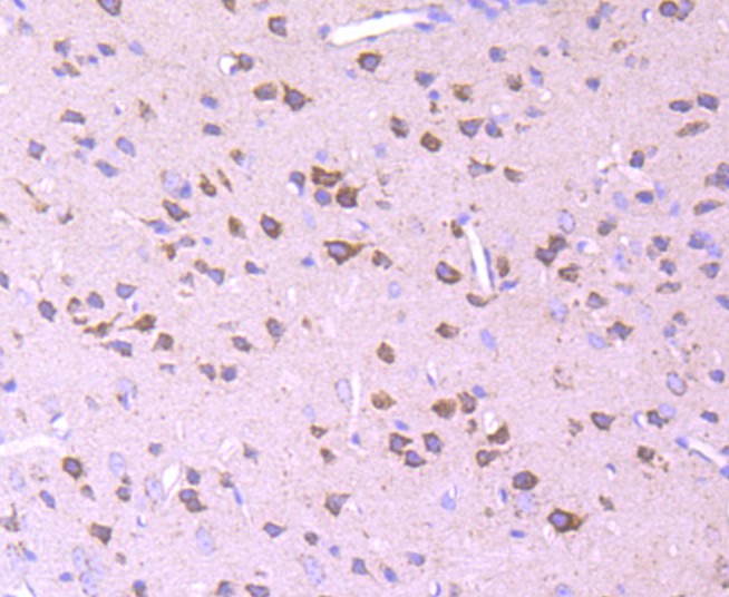Immunohistochemical analysis of paraffin-embedded mouse brain tissue using anti-Pyruvate Dehydrogenase E1 beta subunit antibody. Counter stained with hematoxylin.
