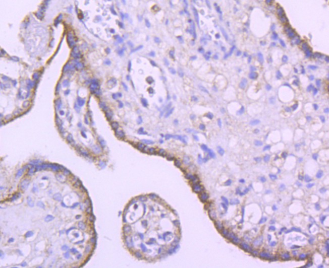 Immunohistochemical analysis of paraffin-embedded human placenta tissue with Rabbit anti-SMYD3 antibody (ET1705-58) at 1/50 dilution.Hela cells<br />
The section was pre-treated using heat mediated antigen retrieval with Tris-EDTA buffer (pH 9.0) for 20 minutes. The tissues were blocked in 1% BSA for 20 minutes at room temperature, washed with ddH2O and PBS, and then probed with the primary antibody (ET1705-58) at 1/50 dilution for 1 hour at room temperature. The detection was performed using an HRP conjugated compact polymer system. DAB was used as the chromogen. Tissues were counterstained with hematoxylin and mounted with DPX.
