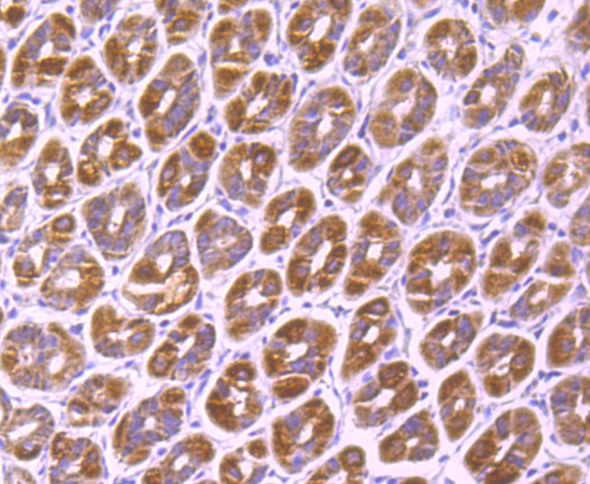 Immunohistochemical analysis of paraffin-embedded mouse stomach tissue  with Rabbit anti-SMYD3 antibody (ET1705-58) at 1/50 dilution.Hela cells<br />
The section was pre-treated using heat mediated antigen retrieval with Tris-EDTA buffer (pH 9.0) for 20 minutes. The tissues were blocked in 1% BSA for 20 minutes at room temperature, washed with ddH2O and PBS, and then probed with the primary antibody (ET1705-58) at 1/50 dilution for 1 hour at room temperature. The detection was performed using an HRP conjugated compact polymer system. DAB was used as the chromogen. Tissues were counterstained with hematoxylin and mounted with DPX.