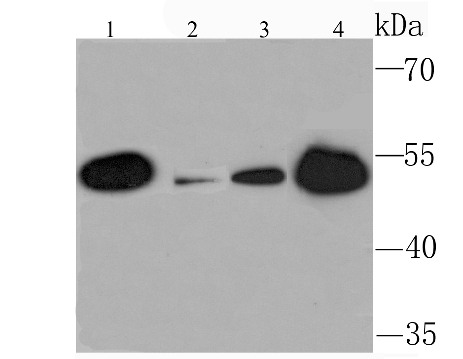 Western blot analysis of KMT5A on different lysates using anti-KMT5A antibody at 1/1,000 dilution.<br />
Positive control:<br />
Lane 1: Mouse kidney tissue lysates<br />
Lane 2: Mouse liver tissue lysates<br />
Lane 3: 293T cell lysates<br />
Lane 4: 293 cell lysates