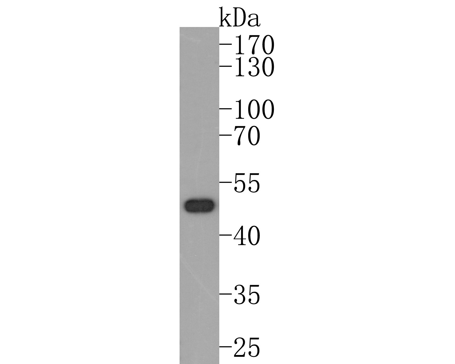 Western blot analysis of Nogo on Hela cell lysates. Proteins were transferred to a PVDF membrane and blocked with 5% BSA in PBS for 1 hour at room temperature. The primary antibody (ET1705-63, 1/500) was used in 5% BSA at room temperature for 2 hours. Goat Anti-Rabbit IgG - HRP Secondary Antibody (HA1001) at 1:200,000 dilution was used for 1 hour at room temperature.