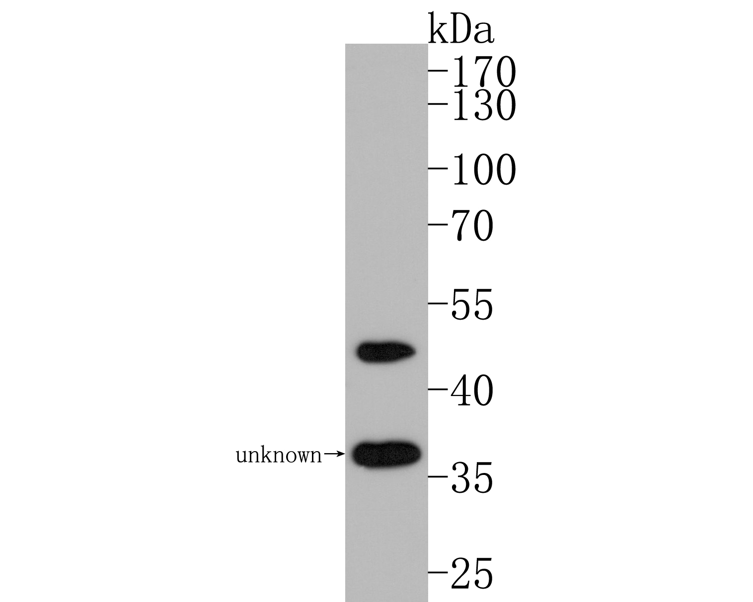 Western blot analysis of Nogo on mouse skeletal muscle tissue lysates. Proteins were transferred to a PVDF membrane and blocked with 5% BSA in PBS for 1 hour at room temperature. The primary antibody (ET1705-63, 1/500) was used in 5% BSA at room temperature for 2 hours. Goat Anti-Rabbit IgG - HRP Secondary Antibody (HA1001) at 1:200,000 dilution was used for 1 hour at room temperature.