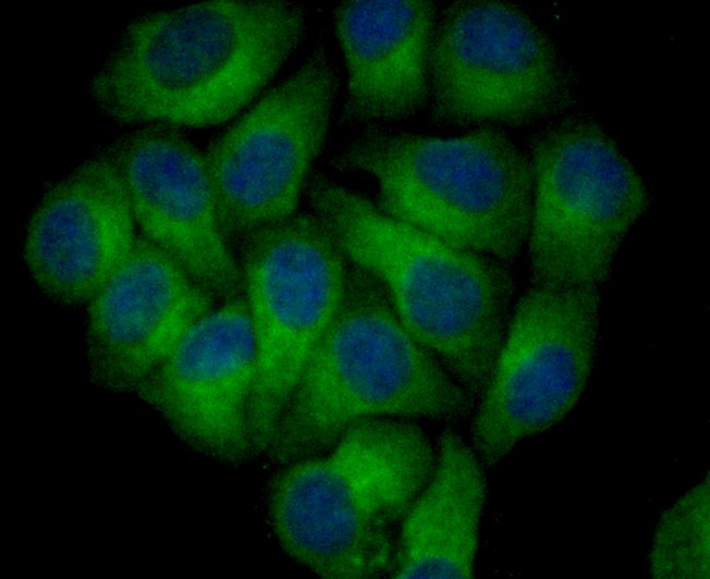 ICC staining of Nogo in HepG2 cells (green). Formalin fixed cells were permeabilized with 0.1% Triton X-100 in TBS for 10 minutes at room temperature and blocked with 10% negative goat serum for 15 minutes at room temperature. Cells were probed with the primary antibody (ET1705-63, 1/50) for 1 hour at room temperature, washed with PBS. Alexa Fluor®488 conjugate-Goat anti-Rabbit IgG was used as the secondary antibody at 1/1,000 dilution. The nuclear counter stain is DAPI (blue).