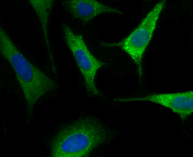 ICC staining of Nogo in SH-SY5Y cells (green). Formalin fixed cells were permeabilized with 0.1% Triton X-100 in TBS for 10 minutes at room temperature and blocked with 10% negative goat serum for 15 minutes at room temperature. Cells were probed with the primary antibody (ET1705-63, 1/50) for 1 hour at room temperature, washed with PBS. Alexa Fluor®488 conjugate-Goat anti-Rabbit IgG was used as the secondary antibody at 1/1,000 dilution. The nuclear counter stain is DAPI (blue).