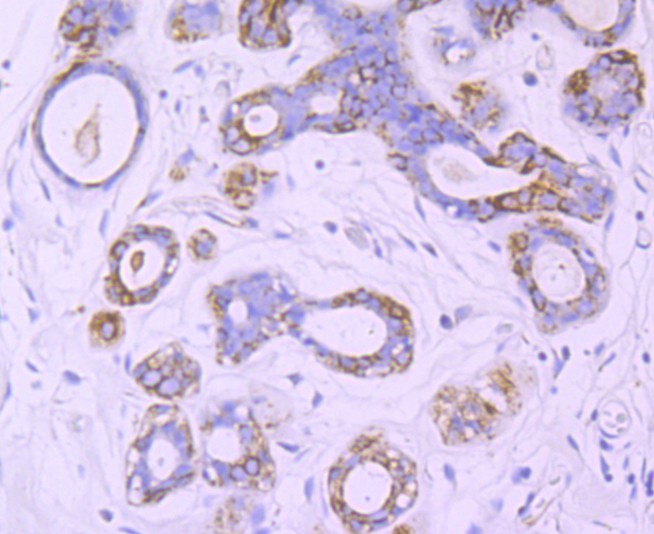 Immunohistochemical analysis of paraffin-embedded human breast tissue using anti-Nogo antibody. The section was pre-treated using heat mediated antigen retrieval with Tris-EDTA buffer (pH 9.0) for 20 minutes.The tissues were blocked in 1% BSA for 30 minutes at room temperature, washed with ddH2O and PBS, and then probed with the primary antibody (ET1705-63, 1/50) for 30 minutes at room temperature. The detection was performed using an HRP conjugated compact polymer system. DAB was used as the chromogen. Tissues were counterstained with hematoxylin and mounted with DPX.