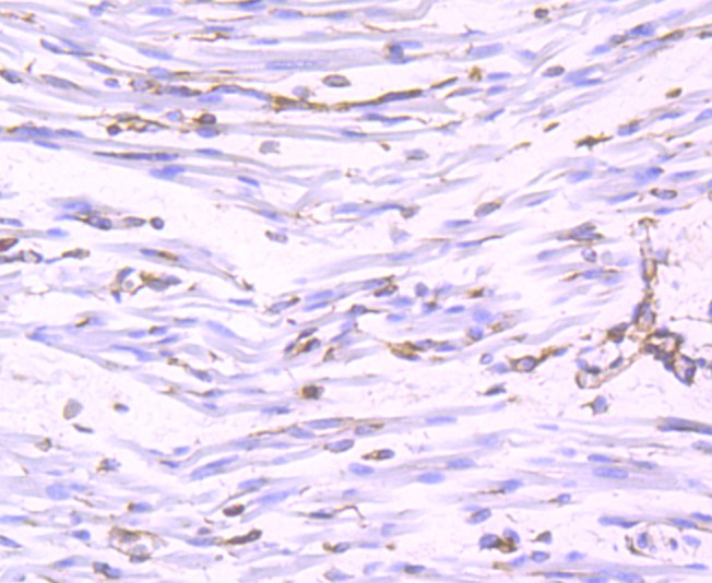 Immunohistochemical analysis of paraffin-embedded human fetal skeletal muscle tissue using anti-Nogo antibody. The section was pre-treated using heat mediated antigen retrieval with Tris-EDTA buffer (pH 9.0) for 20 minutes.The tissues were blocked in 1% BSA for 30 minutes at room temperature, washed with ddH2O and PBS, and then probed with the primary antibody (ET1705-63, 1/50) for 30 minutes at room temperature. The detection was performed using an HRP conjugated compact polymer system. DAB was used as the chromogen. Tissues were counterstained with hematoxylin and mounted with DPX.