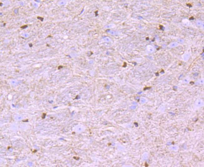 Immunohistochemical analysis of paraffin-embedded mouse brain tissue using anti-Nogo antibody. The section was pre-treated using heat mediated antigen retrieval with Tris-EDTA buffer (pH 9.0) for 20 minutes.The tissues were blocked in 1% BSA for 30 minutes at room temperature, washed with ddH2O and PBS, and then probed with the primary antibody (ET1705-63, 1/50) for 30 minutes at room temperature. The detection was performed using an HRP conjugated compact polymer system. DAB was used as the chromogen. Tissues were counterstained with hematoxylin and mounted with DPX.