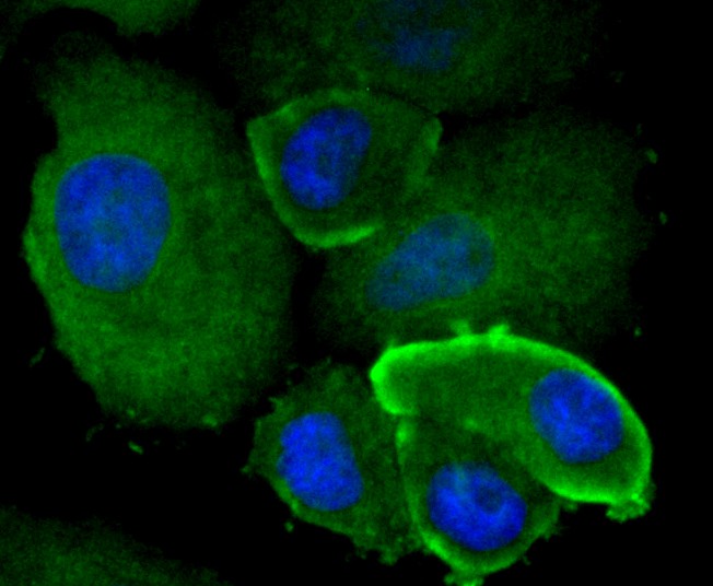 ICC staining of mtTFA in SK-Br-3 cells (green). Formalin fixed cells were permeabilized with 0.1% Triton X-100 in TBS for 10 minutes at room temperature and blocked with 1% Blocker BSA for 15 minutes at room temperature. Cells were probed with the primary antibody (ET1705-64, 1/50) for 1 hour at room temperature, washed with PBS. Alexa Fluor®488 Goat anti-Rabbit IgG was used as the secondary antibody at 1/1,000 dilution. The nuclear counter stain is DAPI (blue).