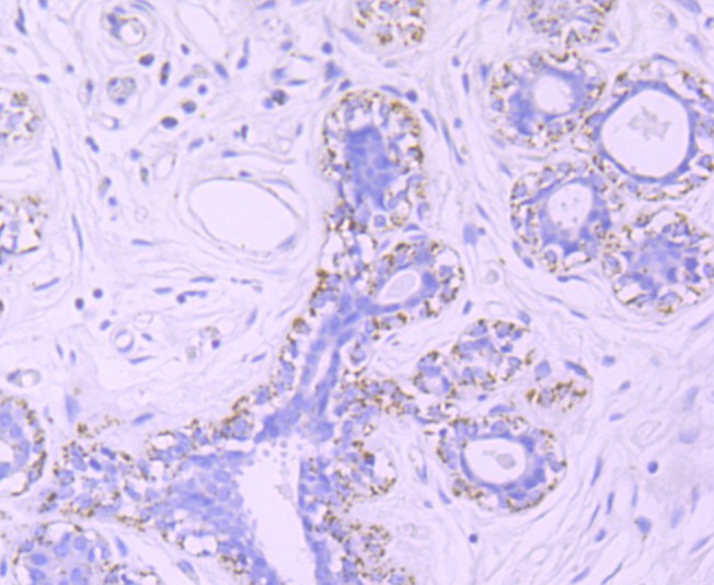 Immunohistochemical analysis of paraffin-embedded human breast tissue using anti-mtTFA antibody. The section was pre-treated using heat mediated antigen retrieval with Tris-EDTA buffer (pH 8.0-8.4) for 20 minutes.The tissues were blocked in 5% BSA for 30 minutes at room temperature, washed with ddH2O and PBS, and then probed with the primary antibody (ET1705-64, 1/50) for 30 minutes at room temperature. The detection was performed using an HRP conjugated compact polymer system. DAB was used as the chromogen. Tissues were counterstained with hematoxylin and mounted with DPX.