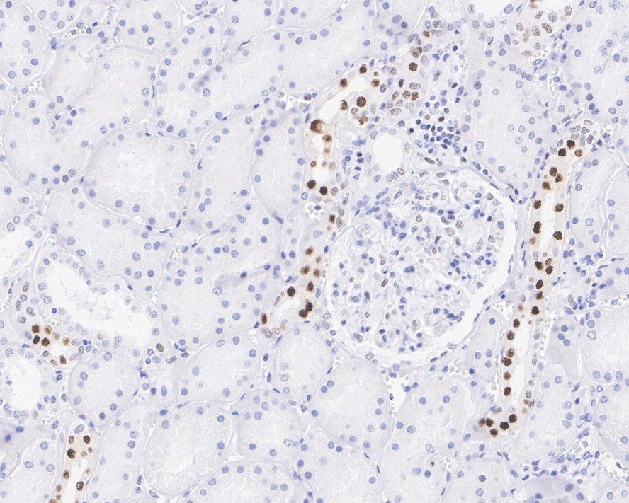 ICC staining of PFKFB3 in A549 cells (green). Formalin fixed cells were permeabilized with 0.1% Triton X-100 in TBS for 10 minutes at room temperature and blocked with 1% Blocker BSA for 15 minutes at room temperature. Cells were probed with the primary antibody (ET1705-66, 1/50) for 1 hour at room temperature, washed with PBS. Alexa Fluor®488 Goat anti-Rabbit IgG was used as the secondary antibody at 1/1,000 dilution. The nuclear counter stain is DAPI (blue).