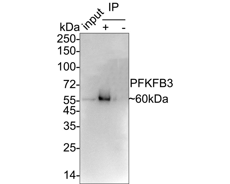 ICC staining of PFKFB3 in Hela cells (green). Formalin fixed cells were permeabilized with 0.1% Triton X-100 in TBS for 10 minutes at room temperature and blocked with 1% Blocker BSA for 15 minutes at room temperature. Cells were probed with the primary antibody (ET1705-66, 1/50) for 1 hour at room temperature, washed with PBS. Alexa Fluor®488 Goat anti-Rabbit IgG was used as the secondary antibody at 1/1,000 dilution. The nuclear counter stain is DAPI (blue).