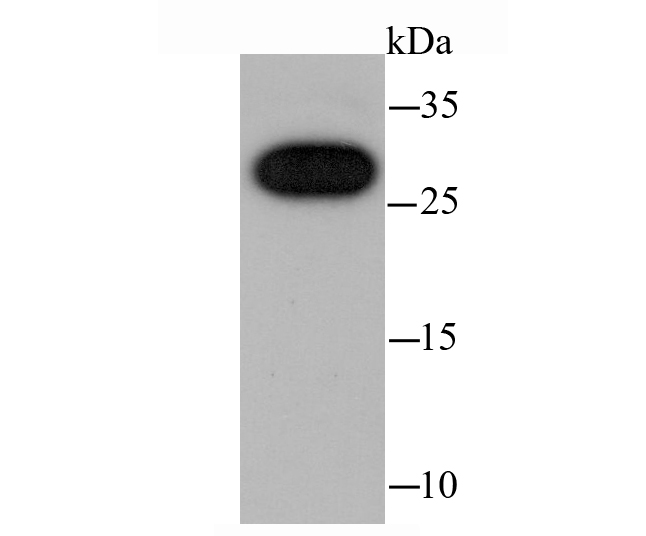 Western blot analysis of cbx7 on A431 cell lysates. Proteins were transferred to a PVDF membrane and blocked with 5% BSA in PBS for 1 hour at room temperature. The primary antibody (ET1705-67, 1/500) was used in 5% BSA at room temperature for 2 hours. Goat Anti-Rabbit IgG - HRP Secondary Antibody (HA1001) at 1:200,000 dilution was used for 1 hour at room temperature.