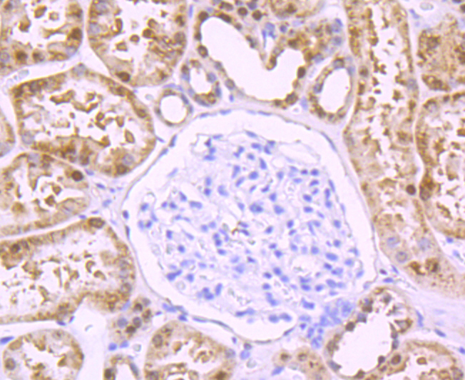 Immunohistochemical analysis of paraffin-embedded human kidney tissue using anti-DDAH1 antibody. Counter stained with hematoxylin.