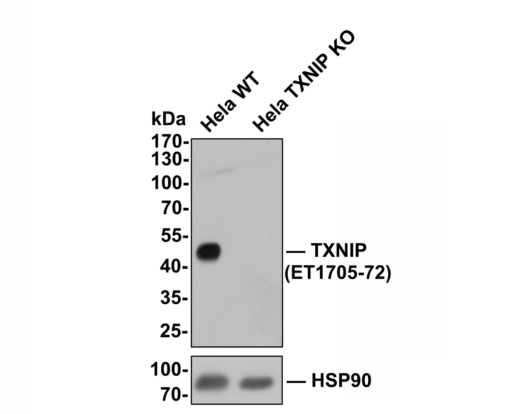 All lanes: Western blot analysis of TXNIP with anti-TXNIP antibody (ET1705-72) at 1/500 dilution.<br />
Lane 1: Wild-type Hela whole cell lysate (10 µg).<br />
Lane 2: TXNIP knockout Hela whole cell lysate (10 µg).<br />
<br />
ET1705-72 was shown to specifically react with TXNIP in wild-type Hela cells. No band was observed when TXNIP knockout sample was tested. Wild-type and TXNIP knockout samples were subjected to SDS-PAGE. Proteins were transferred to a PVDF membrane and blocked with 5% NFDM in TBST for 1 hour at room temperature. The primary antibody (ET1705-72, 1/500) was used in 5% BSA at room temperature for 2 hours. Goat Anti-Rabbit IgG-HRP Secondary Antibody (HA1001) at 1:300,000 dilution was used for 1 hour at room temperature.