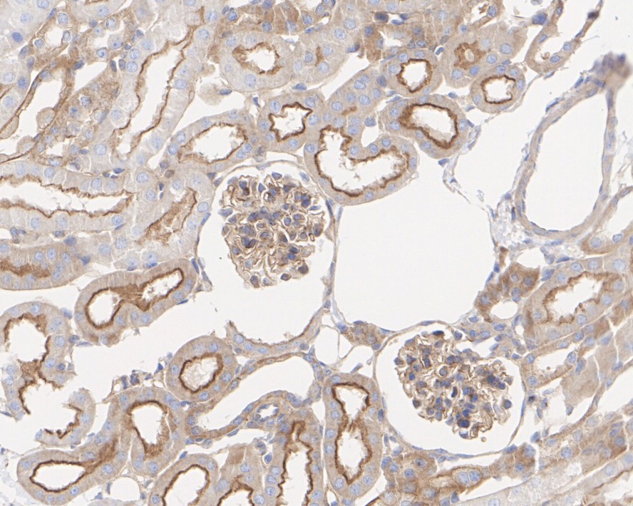 ICC staining of TXNIP in SH-SY5Y cells (green). Formalin fixed cells were permeabilized with 0.1% Triton X-100 in TBS for 10 minutes at room temperature and blocked with 10% negative goat serum for 15 minutes at room temperature. Cells were probed with the primary antibody (ET1705-72, 1/50) for 1 hour at room temperature, washed with PBS. Alexa Fluor®488 conjugate-Goat anti-Rabbit IgG was used as the secondary antibody at 1/1,000 dilution. The nuclear counter stain is DAPI (blue).