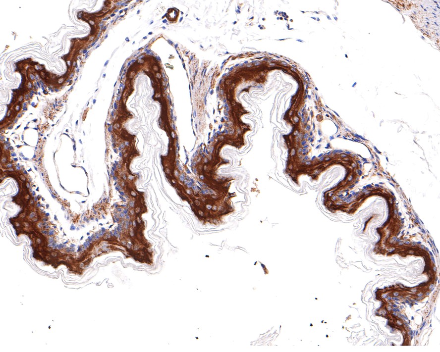 Immunohistochemical analysis of paraffin-embedded human stomach tissue with Rabbit anti-TXNIP antibody (ET1705-72) at 1/400 dilution.<br />
<br />
The section was pre-treated using heat mediated antigen retrieval with Tris-EDTA buffer (pH 9.0) for 20 minutes. The tissues were blocked in 1% BSA for 20 minutes at room temperature, washed with ddH2O and PBS, and then probed with the primary antibody (ET1705-72) at 1/400 dilution for 1 hour at room temperature. The detection was performed using an HRP conjugated compact polymer system. DAB was used as the chromogen. Tissues were counterstained with hematoxylin and mounted with DPX.
