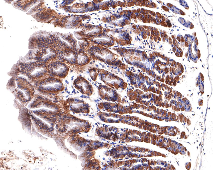 Immunohistochemical analysis of paraffin-embedded mouse esophagus tissue with Rabbit anti-TXNIP antibody (ET1705-72) at 1/400 dilution.<br />
<br />
The section was pre-treated using heat mediated antigen retrieval with Tris-EDTA buffer (pH 9.0) for 20 minutes. The tissues were blocked in 1% BSA for 20 minutes at room temperature, washed with ddH2O and PBS, and then probed with the primary antibody (ET1705-72) at 1/400 dilution for 1 hour at room temperature. The detection was performed using an HRP conjugated compact polymer system. DAB was used as the chromogen. Tissues were counterstained with hematoxylin and mounted with DPX.