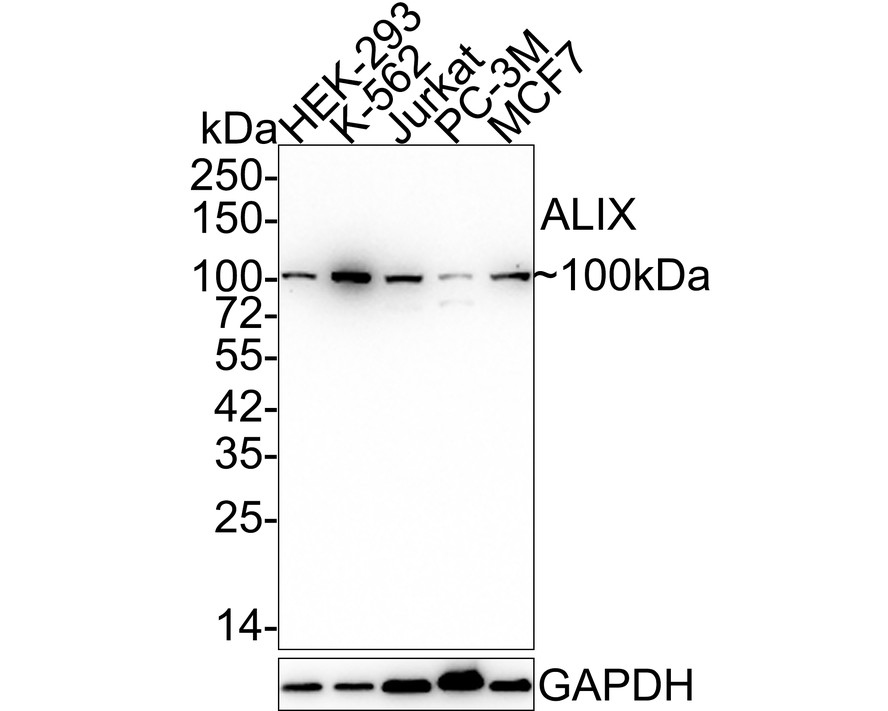 Western blot analysis of ALIX on different lysates with Rabbit anti-ALIX antibody (ET1705-74) at 1/500 dilution.<br />
<br />
Lane 1: SH-SY5Y cell lysate<br />
Lane 2: Hela cell lysate<br />
<br />
Lysates/proteins at 10 µg/Lane.<br />
<br />
Predicted band size: 96 kDa<br />
Observed band size: 96 kDa<br />
<br />
Exposure time: 2 minutes;<br />
<br />
6% SDS-PAGE gel.<br />
<br />
Proteins were transferred to a PVDF membrane and blocked with 5% NFDM/TBST for 1 hour at room temperature. The primary antibody (ET1705-74) at 1/500 dilution was used in 5% NFDM/TBST at room temperature for 2 hours. Goat Anti-Rabbit IgG - HRP Secondary Antibody (HA1001) at 1:300,000 dilution was used for 1 hour at room temperature.