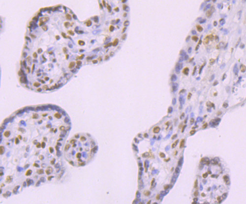 Immunohistochemical analysis of paraffin-embedded human placenta tissue using anti-DNA Ligase IV antibody. The section was pre-treated using heat mediated antigen retrieval with Tris-EDTA buffer (pH 9.0) for 20 minutes.The tissues were blocked in 1% BSA for 30 minutes at room temperature, washed with ddH2O and PBS, and then probed with the primary antibody (ET1705-77, 1/50) for 30 minutes at room temperature. The detection was performed using an HRP conjugated compact polymer system. DAB was used as the chromogen. Tissues were counterstained with hematoxylin and mounted with DPX.