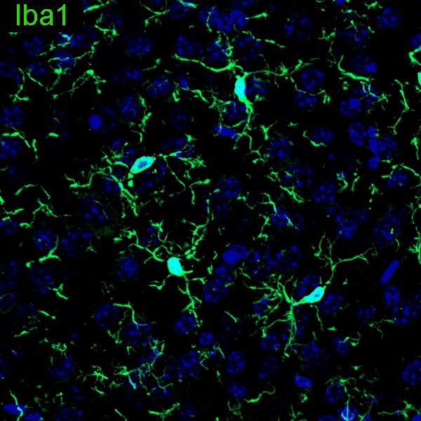 Anti-Brain lipid binding protein Antibody from rabbit, purified by affinity  chromatography