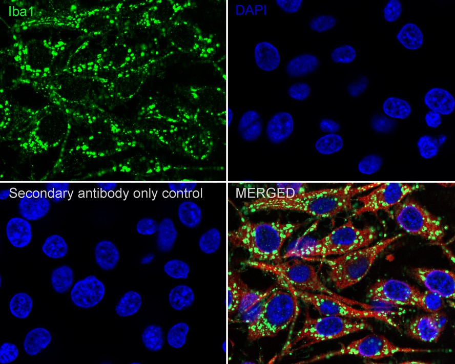 Immunofluorescence analysis of frozen mouse cerebral cortex tissue labeling Iba1 with Rabbit anti-Iba1 antibody (ET1705-78).<br />
<br />
The tissues were blocked in 3% BSA for 30 minutes at room temperature, washed with PBS, and then probed with the primary antibody (ET1705-78, green) at 1/50 dilution overnight at 4℃, washed with PBS. Goat Anti-Rabbit IgG H&L (Alexa Fluor® 488) was used as the secondary antibody at 1/200 dilution. Nuclei were counterstained with DAPI (blue). Image acquisition was performed with KFBIO KF-FL-400 Scanner.