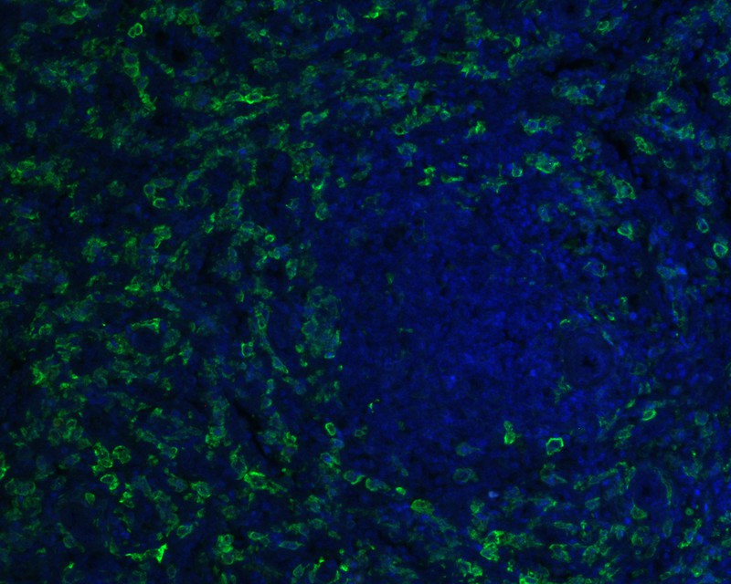 Immunofluorescence analysis of frozen mouse hippocampus tissue labeling Iba1 with Rabbit anti-Iba1 antibody (ET1705-78).<br />
<br />
The tissues were blocked in 3% BSA for 30 minutes at room temperature, washed with PBS, and then probed with the primary antibody (ET1705-78, green) at 1/50 dilution overnight at 4℃, washed with PBS. Goat Anti-Rabbit IgG H&L (Alexa Fluor® 488) was used as the secondary antibody at 1/200 dilution. Nuclei were counterstained with DAPI (blue). Image acquisition was performed with KFBIO KF-FL-400 Scanner.