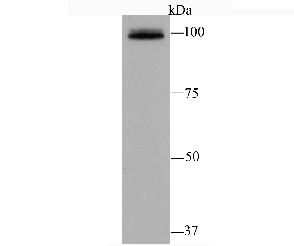 Western blot analysis of Epac1 on mouse kidney tissue lysates. Proteins were transferred to a PVDF membrane and blocked with 5% BSA in PBS for 1 hour at room temperature. The primary antibody (ET1705-79, 1/500) was used in 5% BSA at room temperature for 2 hours. Goat Anti-Rabbit IgG - HRP Secondary Antibody (HA1001) at 1:200,000 dilution was used for 1 hour at room temperature.<br />
<br />
Predicted band size: 104 kDa<br />
Observed band size: 100 kDa