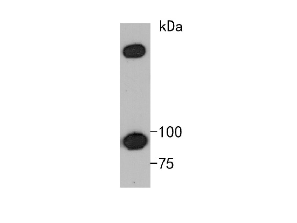 Western blot analysis of Epac1 on PC-3 cell lysates. Proteins were transferred to a PVDF membrane and blocked with 5% BSA in PBS for 1 hour at room temperature. The primary antibody (ET1705-79, 1/500) was used in 5% BSA at room temperature for 2 hours. Goat Anti-Rabbit IgG - HRP Secondary Antibody (HA1001) at 1:200,000 dilution was used for 1 hour at room temperature.<br />
<br />
Predicted band size: 104 kDa<br />
Observed band size: 95 kDa