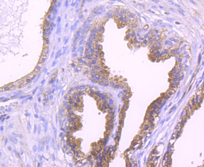 Immunohistochemical analysis of paraffin-embedded human prostate tissue using anti-Epac1 antibody. The section was pre-treated using heat mediated antigen retrieval with Tris-EDTA buffer (pH 9.0) for 20 minutes.The tissues were blocked in 1% BSA for 30 minutes at room temperature, washed with ddH2O and PBS, and then probed with the primary antibody (ET1705-79, 1/50) for 30 minutes at room temperature. The detection was performed using an HRP conjugated compact polymer system. DAB was used as the chromogen. Tissues were counterstained with hematoxylin and mounted with DPX.