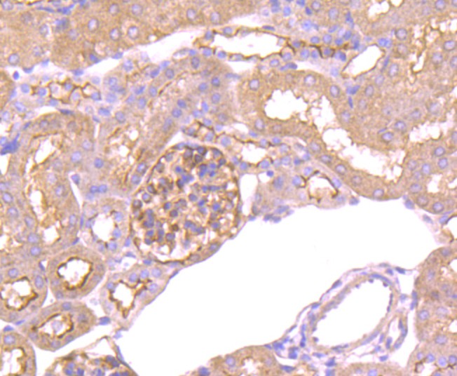 Immunohistochemical analysis of paraffin-embedded mouse kidney tissue using anti-Epac1 antibody. The section was pre-treated using heat mediated antigen retrieval with Tris-EDTA buffer (pH 9.0) for 20 minutes.The tissues were blocked in 1% BSA for 30 minutes at room temperature, washed with ddH2O and PBS, and then probed with the primary antibody (ET1705-79, 1/50) for 30 minutes at room temperature. The detection was performed using an HRP conjugated compact polymer system. DAB was used as the chromogen. Tissues were counterstained with hematoxylin and mounted with DPX.