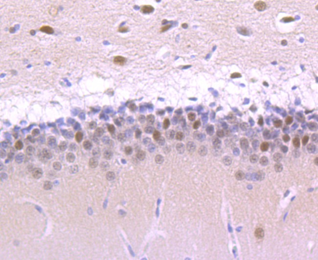 Immunohistochemical analysis of paraffin-embedded rat brain tissue using anti-Cullin 1 antibody. The section was pre-treated using heat mediated antigen retrieval with Tris-EDTA buffer (pH 9.0) for 20 minutes.The tissues were blocked in 1% BSA for 30 minutes at room temperature, washed with ddH2O and PBS, and then probed with the primary antibody (ET1705-82, 1/50) for 30 minutes at room temperature. The detection was performed using an HRP conjugated compact polymer system. DAB was used as the chromogen. Tissues were counterstained with hematoxylin and mounted with DPX.