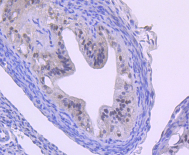 Immunohistochemical analysis of paraffin-embedded human fallopian tube tissue using anti-Cullin 1 antibody. The section was pre-treated using heat mediated antigen retrieval with Tris-EDTA buffer (pH 9.0) for 20 minutes.The tissues were blocked in 1% BSA for 30 minutes at room temperature, washed with ddH2O and PBS, and then probed with the primary antibody (ET1705-82, 1/50) for 30 minutes at room temperature. The detection was performed using an HRP conjugated compact polymer system. DAB was used as the chromogen. Tissues were counterstained with hematoxylin and mounted with DPX.