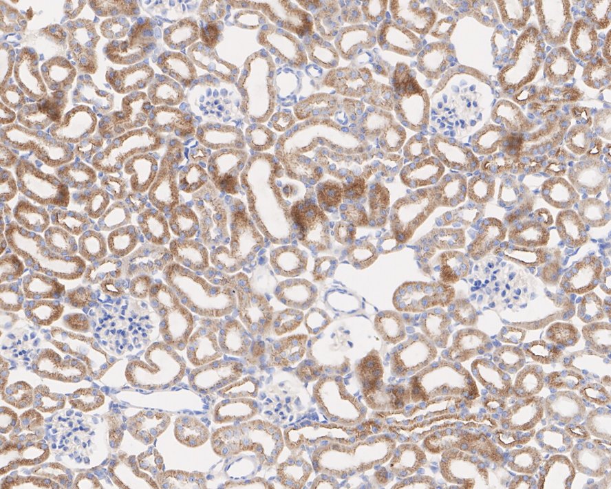 Immunohistochemical analysis of paraffin-embedded human kidney tissue with Rabbit anti-JAK1 antibody (ET1705-84) at 1/200 dilution.<br />
<br />
The section was pre-treated using heat mediated antigen retrieval with Tris-EDTA buffer (pH 9.0) for 20 minutes. The tissues were blocked in 1% BSA for 20 minutes at room temperature, washed with ddH2O and PBS, and then probed with the primary antibody (ET1705-84) at 1/200 dilution for 1 hour at room temperature. The detection was performed using an HRP conjugated compact polymer system. DAB was used as the chromogen. Tissues were counterstained with hematoxylin and mounted with DPX.