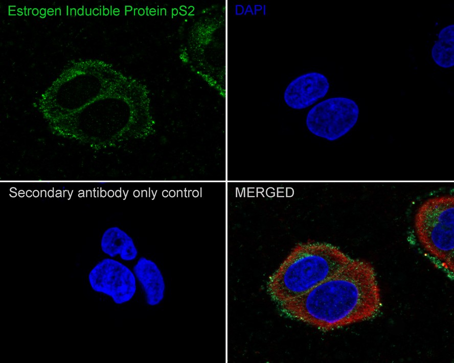 ICC staining of Estrogen Inducible Protein pS2 in MCF-7 cells (green). Formalin fixed cells were permeabilized with 0.1% Triton X-100 in TBS for 10 minutes at room temperature and blocked with 10% negative goat serum for 15 minutes at room temperature. Cells were probed with the primary antibody (ET1705-85, 1/50) for 1 hour at room temperature, washed with PBS. Alexa Fluor®488 conjugate-Goat anti-Rabbit IgG was used as the secondary antibody at 1/1,000 dilution. The nuclear counter stain is DAPI (blue).