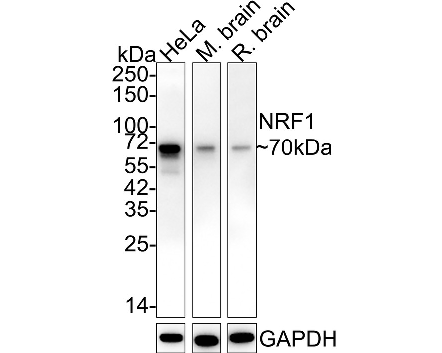 Western blot analysis of NRF1 on different lysates with Rabbit anti-NRF1 antibody (ET1705-86) at 1/500 dilution.<br />
<br />
Lane 1: Jurkat cell lysate<br />
Lane 2: Hela cell lysate<br />
<br />
Lysates/proteins at 10 µg/Lane.<br />
<br />
Predicted band size: 54 kDa<br />
Observed band size: 70 kDa<br />
<br />
Exposure time: 2 minutes;<br />
<br />
8% SDS-PAGE gel.<br />
<br />
Proteins were transferred to a PVDF membrane and blocked with 5% NFDM/TBST for 1 hour at room temperature. The primary antibody (ET1705-86) at 1/500 dilution was used in 5% NFDM/TBST at room temperature for 2 hours. Goat Anti-Rabbit IgG - HRP Secondary Antibody (HA1001) at 1:300,000 dilution was used for 1 hour at room temperature.