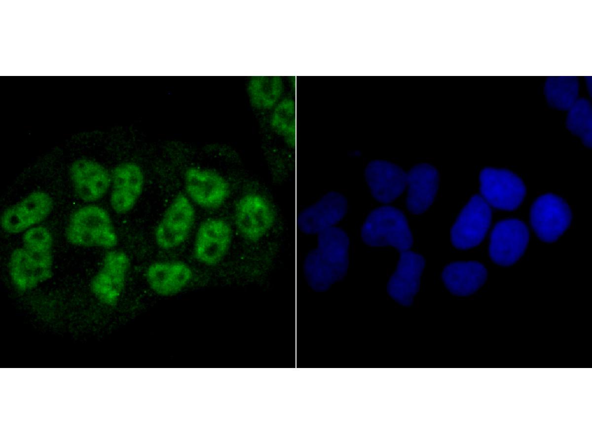 ICC staining of NRF1 in Hela cells (green). Formalin fixed cells were permeabilized with 0.1% Triton X-100 in TBS for 10 minutes at room temperature and blocked with 1% Blocker BSA for 15 minutes at room temperature. Cells were probed with the primary antibody (ET1705-86, 1/50) for 1 hour at room temperature, washed with PBS. Alexa Fluor®488 Goat anti-Rabbit IgG was used as the secondary antibody at 1/1,000 dilution. The nuclear counter stain is DAPI (blue).